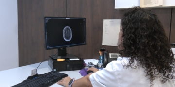 Controlar els factors de risc cardiovasculars pot ajudar a frenar l’evolució de l’Alzheimer
